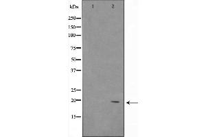 Western blot analysis of ASH2 using 293 whole cell lysates (ASH2L Antikörper  (Internal Region))