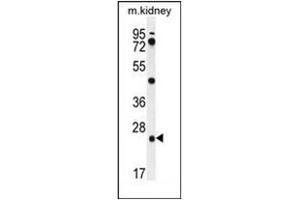 Western blot analysis of PGPEP1 Antibody (N-term) in mouse kidney tissue lysates (35ug/lane). (PGPEP1 Antikörper  (N-Term))