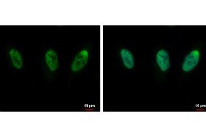 ICC/IF Image CIP29 antibody [N1C3] detects CIP29 protein at nucleus by immunofluorescent analysis.