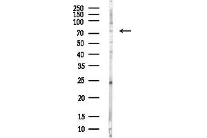Western blot analysis of lysates from COLO205 cells(heat-shock,45 min treatment), using ATG7 Antibody at 1/1000 dilution.
