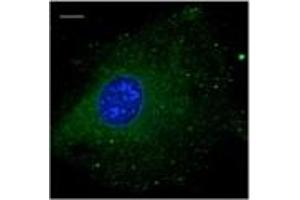 Immunofluorescence — anti-Rab5b Ab using B6-RPE07 cells at 1/100 dilutlon; (RAB5B Antikörper  (C-Term))