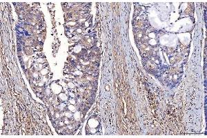 IHC analysis of ENO1 using anti-ENO1 antibody (ABIN7601902).