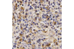 Immunohistochemistry (IHC) image for anti-ATP-Binding Cassette, Sub-Family A (ABC1), Member 6 (ABCA6) antibody (ABIN1870712) (ABCA6 Antikörper)