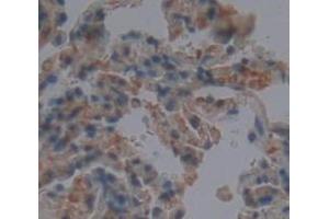 IHC-P analysis of Human Tissue, with DAB staining. (CLEC3B Antikörper  (AA 22-202))