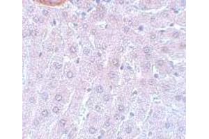 Immunohistochemistry (IHC) image for anti-Cell Division Cycle 27 Homolog (S. Cerevisiae) (CDC27) (C-Term) antibody (ABIN1030244)