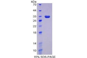SDS-PAGE analysis of Human DNMT1 Protein. (DNMT1 Protein)