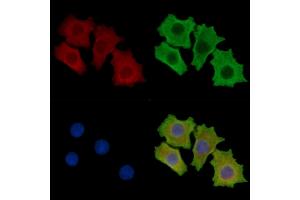 ABIN7095688 and ABIN7099750 staining HepG2 cells by IF/ICC. (ASIC3 Antikörper)