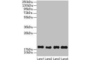 Western Blot All lanes: PPIAL4G antibody at 6 μg/mL Lane 1: Mouse liver tissue Lane 2: Mouse spleen tissue Lane 3: Mouse lung tissue Lane 4: Mouse kidney tissue Secondary Goat polyclonal to rabbit IgG at 1/10000 dilution Predicted band size: 19 kDa Observed band size: 19 kDa (PPIAL4G Antikörper  (AA 1-164))