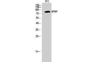 Western Blotting (WB) image for anti-ATR Interacting Protein (ATRIP) (Tyr783) antibody (ABIN3179886) (ATRIP Antikörper  (Tyr783))