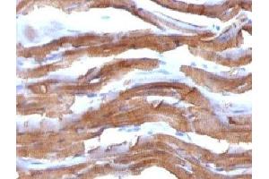 IHC testing of FFPE rat heart with Muscle Actin antibody