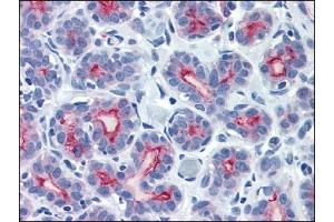 Immunohistochemistry (IHC) image for anti-Mucin 1 (MUC1) (C-Term) antibody (ABIN371859) (MUC1 Antikörper  (C-Term))