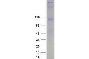 Western Blotting (WB) image for Wolfram Syndrome 1 (WFS1) (Transcript Variant 2) protein (Myc-DYKDDDDK Tag) (ABIN2735629)
