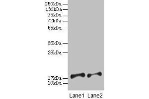 Western blot All lanes: PFDN5 antibody at 2 μg/mL Lane 1: EC109 whole cell lysate Lane 2: 293T whole cell lysate Secondary Goat polyclonal to rabbit IgG at 1/15000 dilution Predicted band size: 18, 8, 13 kDa Observed band size: 18 kDa (PFDN5 Antikörper  (AA 2-154))