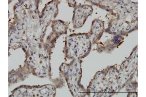 Immunoperoxidase of monoclonal antibody to NT5C2 on formalin-fixed paraffin-embedded human placenta. (NT5C2 Antikörper  (AA 1-561))