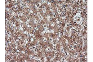 Image no. 3 for anti-Mitogen-Activated Protein Kinase Kinase 1 (MAP2K1) antibody (ABIN1499388) (MEK1 Antikörper)