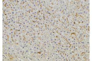 ABIN6274745 at 1/100 staining Mouse liver tissue by IHC-P.