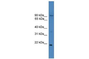 WB Suggested Anti-FOXM1 Antibody Titration:  1 ug/ml  Positive Control:  THP-1 cell lysate (FOXM1 Antikörper  (N-Term))