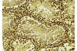 ABIN6276529 at 1/100 staining Mouse testis tissue by IHC-P. (CRADD Antikörper  (Internal Region))