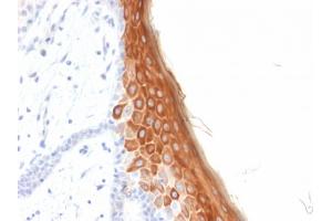 Formalin-fixed, paraffin-embedded human Skin stained with Cytokeratin 10 Mouse Recombinant Monoclonal Antibody (rKRT10/844). (Rekombinanter Keratin 10 Antikörper)