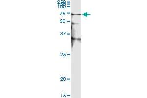 Immunoprecipitation (IP) image for anti-serine/threonine Kinase 38 (STK38) (AA 1-466) antibody (ABIN599179) (STK38 Antikörper  (AA 1-466))