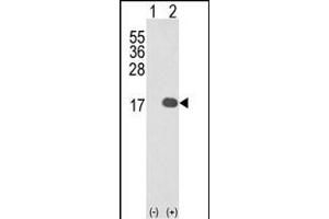 Western blot analysis of IL1F8 (arrow) using rabbit polyclonal IL1F8 Antibody (N-term) (ABIN652903 and ABIN2842583).