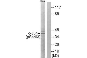 Western Blotting (WB) image for anti-Jun Proto-Oncogene (JUN) (pSer63) antibody (ABIN1847456) (C-JUN Antikörper  (pSer63))