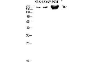 Western Blot (WB) analysis of KB SH-SY5Y 293T lysis using Flt-1 antibody. (FLT1 Antikörper  (Ser385))