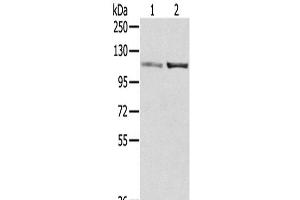 Western Blot analysis of A172 and 231 cells using SENP7 Polyclonal Antibody at dilution of 1/800 (SENP7 Antikörper)