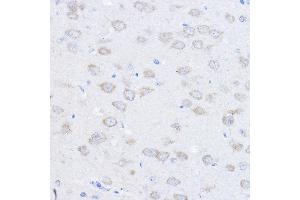 Immunohistochemistry of paraffin-embedded rat brain using UBE4A Rabbit pAb (ABIN6128897, ABIN6149841, ABIN6149842 and ABIN6220229) at dilution of 1:100 (40x lens). (UBE4A Antikörper  (AA 797-1066))