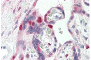 Human Placenta (formalin-fixed, paraffin-embedded) stained with CDK2 antibody ABIN337208 at 5 ug/ml followed by biotinylated anti-mouse IgG secondary antibody ABIN481714, alkaline phosphatase-streptavidin and chromogen. (CDK2 Antikörper)