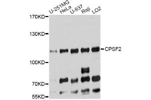 Western blot analysis of extracts of various cell lines, using CPSF2 antibody. (CPSF2 Antikörper)