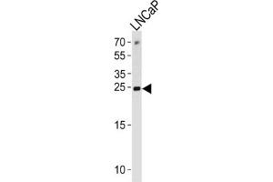 Western Blotting (WB) image for anti-Tumor Protein, Translationally-Controlled 1 (TPT1) antibody (ABIN3003778) (TPT1 Antikörper)