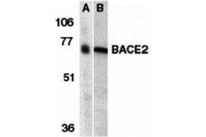 Western Blotting (WB) image for anti-beta-Site APP-Cleaving Enzyme 2 (BACE2) (N-Term) antibody (ABIN1031256) (BACE2 Antikörper  (N-Term))