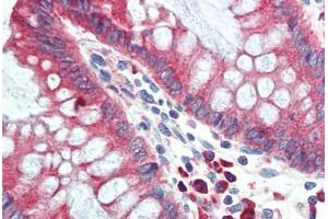 Human Colon (formalin-fixed, paraffin-embedded) stained with HYOU1 antibody ABIN396969 at 5 ug/ml followed by biotinylated goat anti-rabbit IgG secondary antibody ABIN481713, alkaline phosphatase-streptavidin and chromogen. (HYOU1 Antikörper  (C-Term))