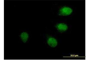 Immunofluorescence of purified MaxPab antibody to ANAPC10 on HeLa cell. (ANAPC10 Antikörper  (AA 1-185))