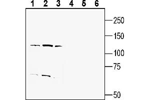 Western blot analysis of human  monocytic leukemia cell line lysate (lanes 1 and 4), human  promyelocytic leukemia cell line lysate (lanes 2 and 5) and human MDA- breast adenocarcinoma cell line lysate (lanes 3 and 6):1-3. (ENPP1 Antikörper  (Extracellular))