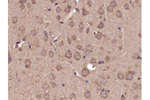 Paraformaldehyde-fixed, paraffin embedded rat brain tissue, Antigen retrieval by boiling in sodium citrate buffer (pH6. (Glutamate Receptor 1 Antikörper  (pSer863))