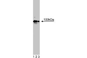 Western blot analysis of R-Cadherin on rat brain lysate. (Cadherin 4 Antikörper  (AA 22-201))