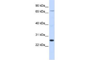 WB Suggested Anti-ZNF267 Antibody Titration:  0. (ZNF267 Antikörper  (Middle Region))