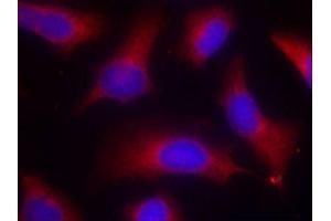 Immunofluorescence staining of methanol-fixed HeLa cells using Phospho-MAPT-S262 antibody (ABIN2988151). (MAPT Antikörper  (pSer262))