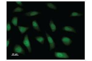Immunostaining analysis in HeLa cells. (KDM4A Antikörper)