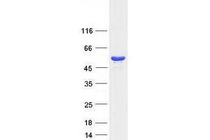 Western Blotting (WB) image for Protein Kinase, CAMP-Dependent, Regulatory, Type I, alpha (Tissue Specific Extinguisher 1) (PRKAR1A) (Transcript Variant 1) protein (Myc-DYKDDDDK Tag) (ABIN2729580)