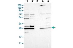 Western blot analysis of Lane 1: RT-4, Lane 2: U-251 MG, Lane 3: Human Plasma, Lane 4: Liver, Lane 5: Tonsil with CNPY4 polyclonal antibody . (CNPY4 Antikörper)