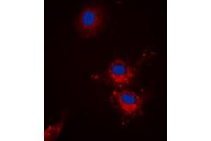 Immunofluorescent analysis of BCLX (pS62) staining in HEK293T cells. (BCL2L1 Antikörper  (pSer62))