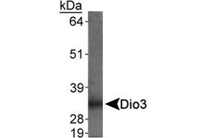 Detection of Dio3 in rat placenta using Dio3 polyclonal antibody . (DIO3 Antikörper  (AA 250-300))