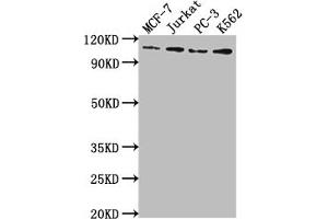 Western Blot Positive WB detected in: MCF-7 whole cell lysate, Jurkat whole cell lysate, PC-3 whole cell lysate, K562 whole cell lysate All lanes: KDM1A antibody at 1:2000 Secondary Goat polyclonal to rabbit IgG at 1/50000 dilution Predicted band size: 93, 96 kDa Observed band size: 110 kDa (Rekombinanter LSD1 Antikörper)