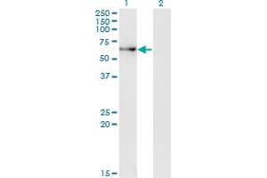 Western Blot analysis of ACD expression in transfected 293T cell line by ACD monoclonal antibody (M01A), clone 1C11-1A7.