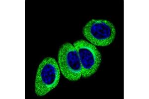 Confocal immunofluorescent analysis ofPhospho-ATM-p Antibody (ABIN389888 and ABIN2839734) with Hela cell followed by Alexa Fluor 488-conjugated goat anti-rabbit lgG (green). (ATM Antikörper  (pSer1981))