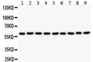 Anti- SMAD4 Picoband antibody, Western blotting All lanes: Anti SMAD4  at 0. (SMAD4 Antikörper  (C-Term))