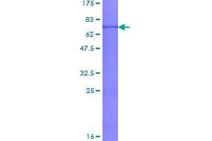 Medium-Chain Specific Acyl-CoA Dehydrogenase, Mitochondrial (MCAD) (AA 1-421) protein (GST tag)